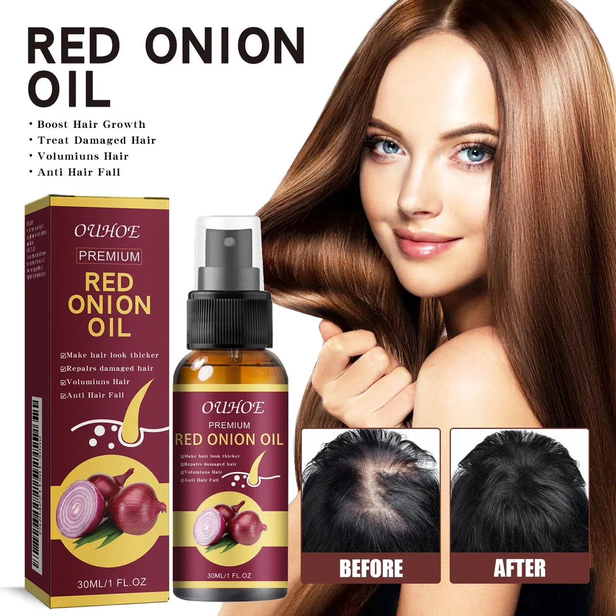 Red Onion Hair Growth Essential Oil Spray – Nourish & Strengthen Hair Growth Spray Qme