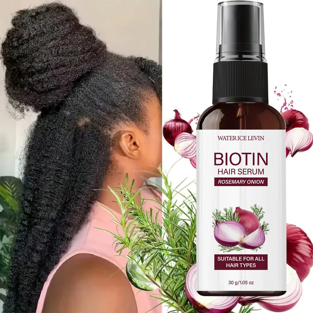 Biotin Rosemary Onion Hair Growth Serum – All Hair Types | Qme Hair Growth Serum Qme
