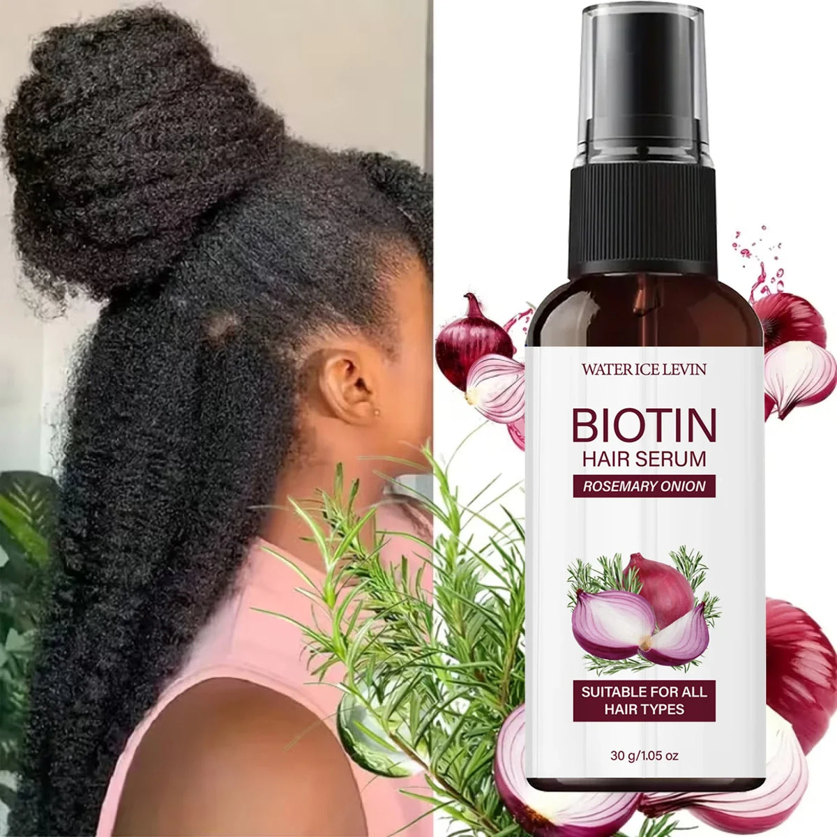 Biotin Rosemary Onion Hair Growth Serum – All Hair Types | Qme Hair Growth Serum Qme