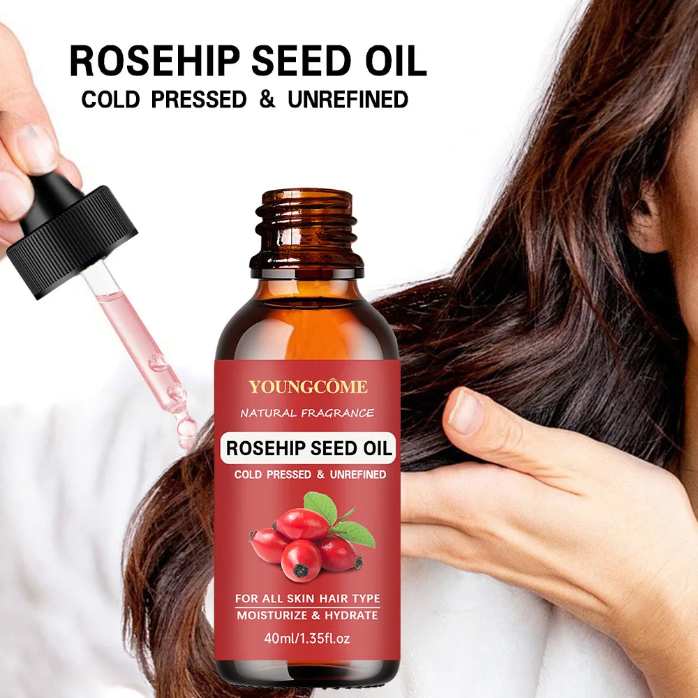 YOUNGCOME Rose Essential Oil – Aromatherapy & Skin Care 40/60ml Essential Oil Qst
