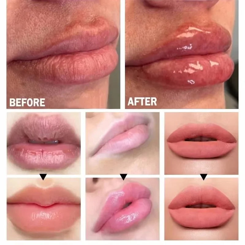 Lip Plumping Essential Oil Serum – Nourishing & Volumising Lip Plumping Serum Qme