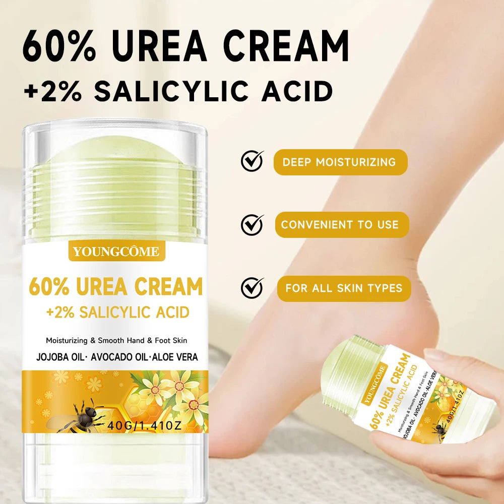 YOUNGCOME 60% Urea + 2% Salicylic Acid Foot Cream & Deodorant Foot Cream & Deodorant Qst