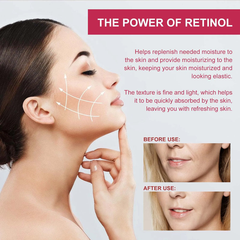 V-Shape Firming Face-Lift Slimming Mask | Chin Contouring Face Contouring Mask Qme