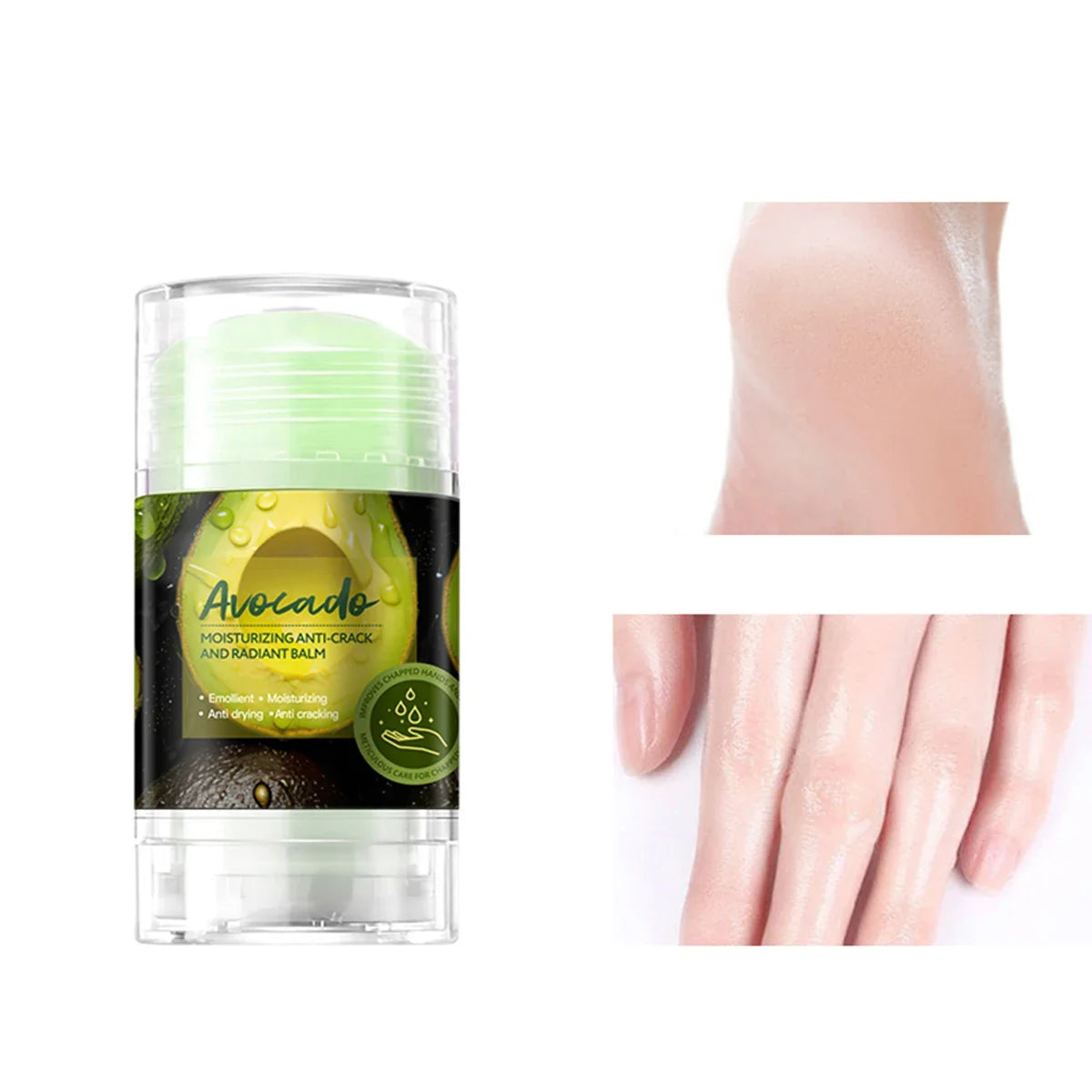 Avocado Hand & Foot Moisturizing Cream – Dry Skin Care Hand & Foot Cream Qme