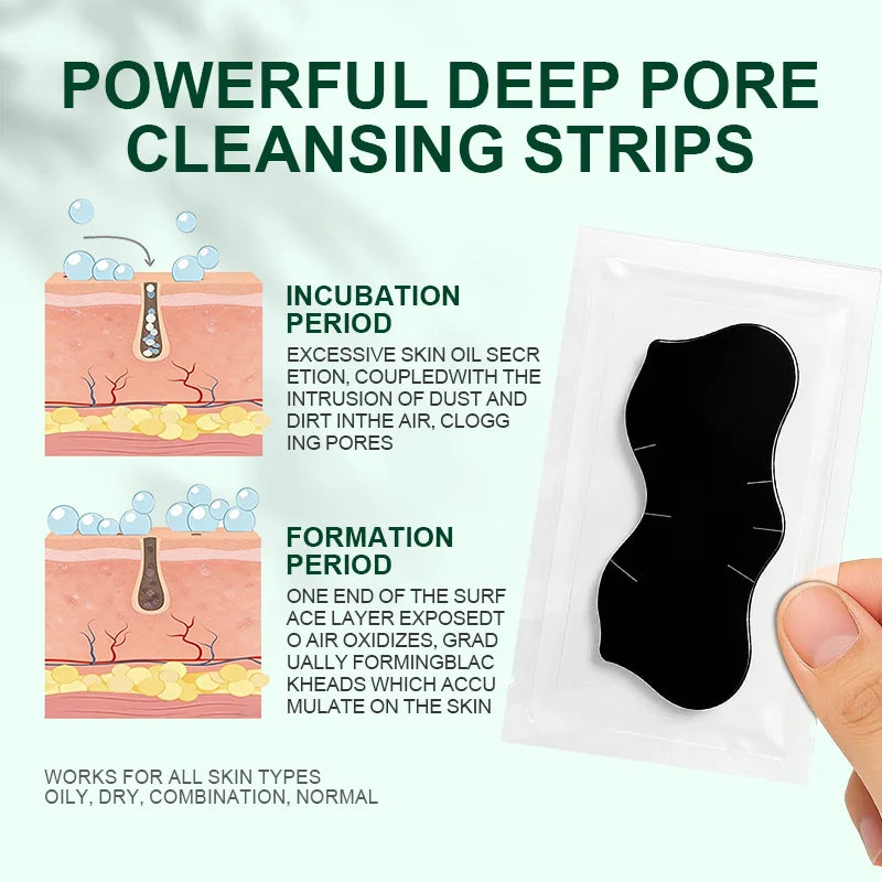 Charcoal Blackhead Remover Nose Strips – Deep Pore Cleansing Pore Cleansing Strips Qst