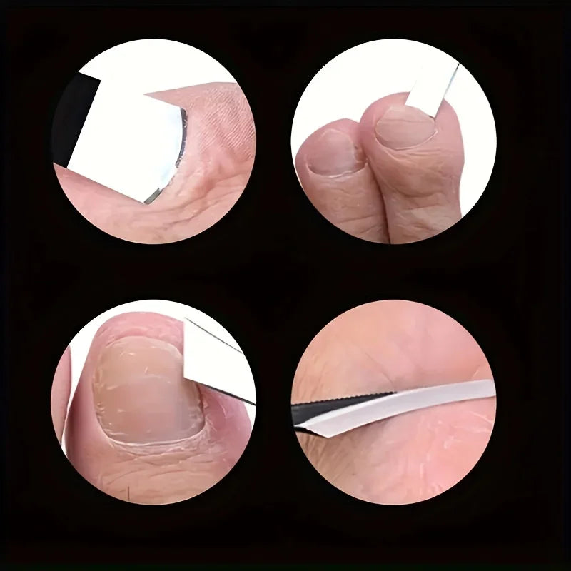 Stainless Steel Foot Care Exfoliating Scraper & Nail Kit Foot Care Kit Qme