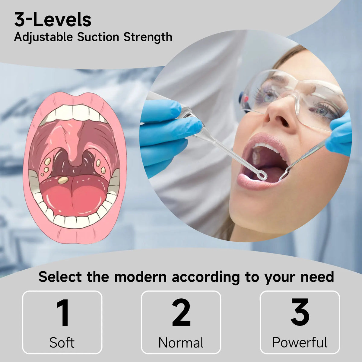 Electric Tonsil Stone Remover – LED, 8 Suction Modes, Oral Kit Oral Care Device Qst