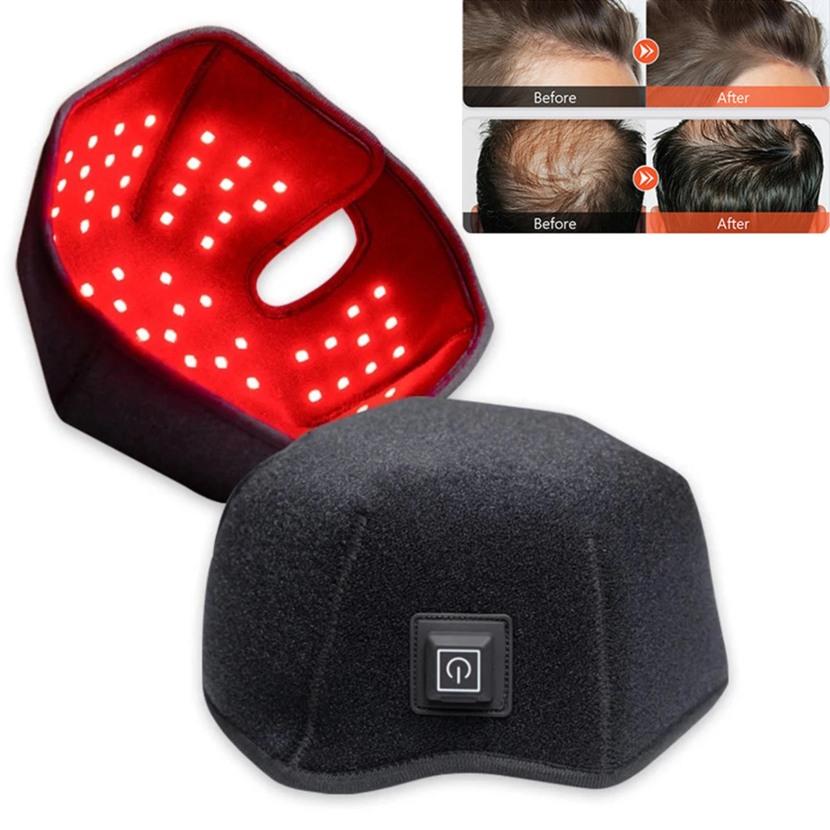 300-Beam LED Hair Growth Cap – 650nm 850nm Red Light Therapy LED Hair Growth Cap Qst