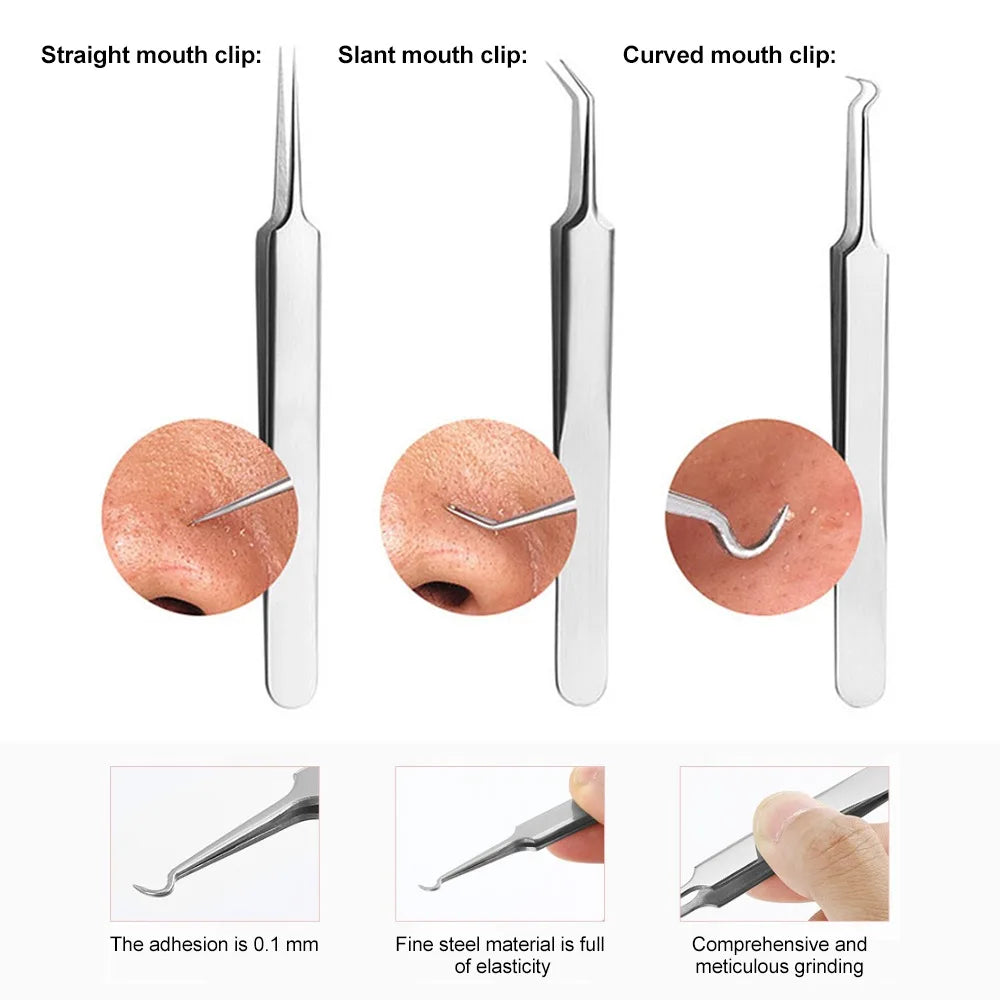 Precision Stainless Steel Blackhead & Pore Cleansing Tweezers Facial Skincare Tool Qme