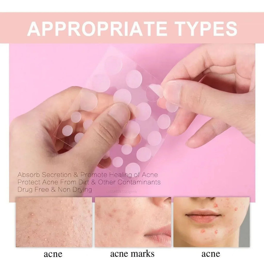 Invisible Hydrocolloid Acne Patches 72pcs – Clear Spot Stickers Acne Spot Patches Qme