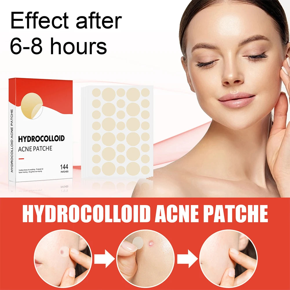 144pcs Hydrocolloid Acne Pimple Patches – 2 Sizes, Invisible Acne Spot Patches Qst