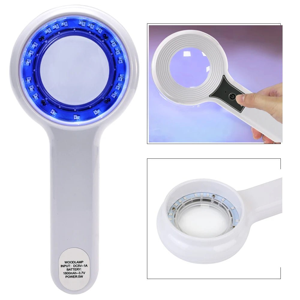 Woods Lamp UV Skin Analyzer – Portable LED 3x Magnifying Skin Analysis Lamp Qst