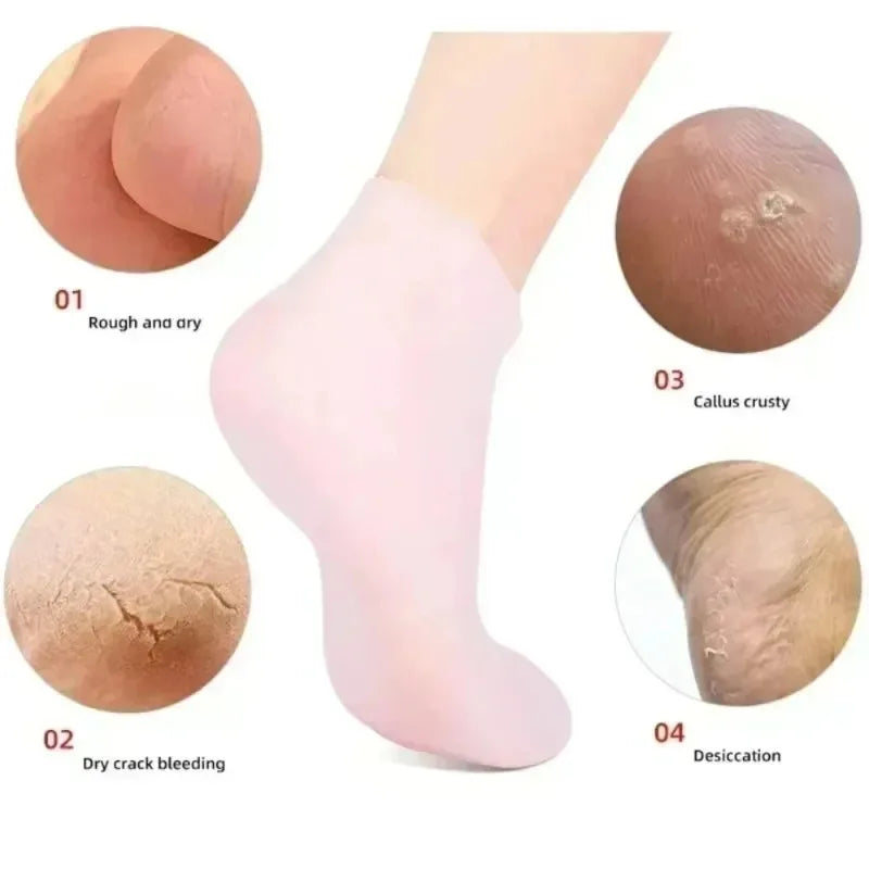 Silicone Moisturizing Gloves & Socks – Hands & Feet Care Set Moisturizing Spa Gloves Qme