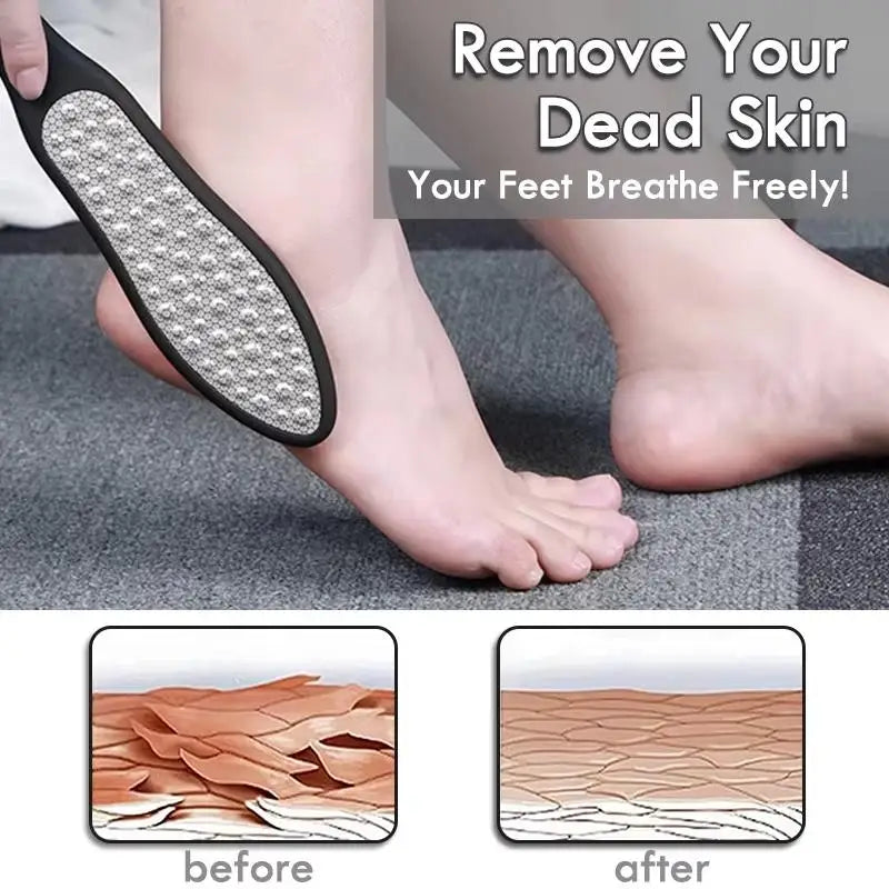 Dual-Sided Stainless Steel Foot File Pedicure Tool | Qme Foot File Tool Qme