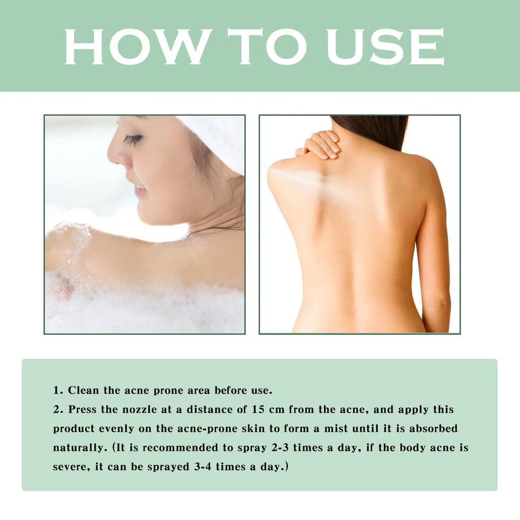 Eelhoe Back & Body Acne Clarifying Spray – 120ml Serum Body Acne Spray Qst