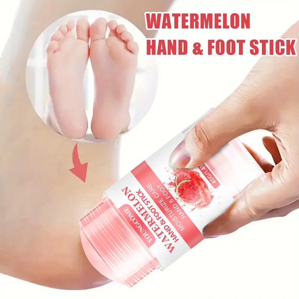 YOUNGCOME Watermelon Foot Cream – Hydrating Daily Foot Care Foot Cream Qst