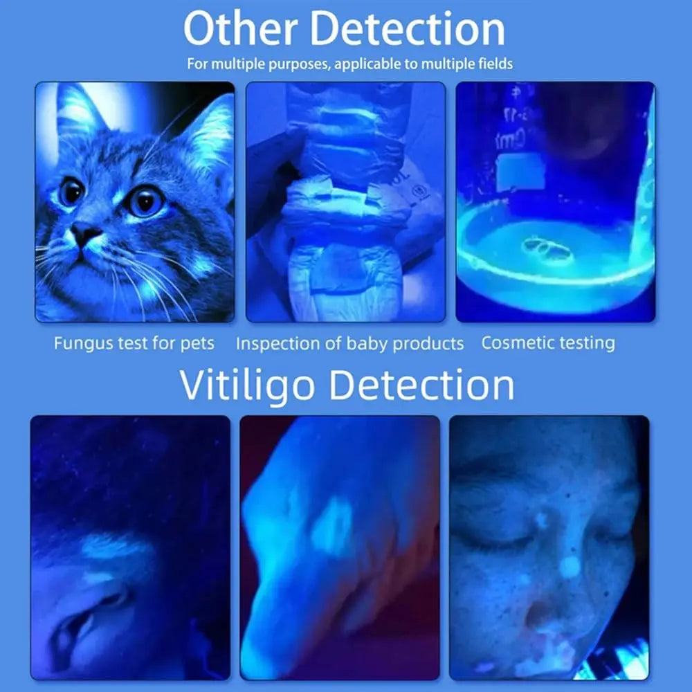 Wood's Lamp Skin Analyzer – 365nm UV, 16 LED, 4000mAh UV Skin Analyzer Qst