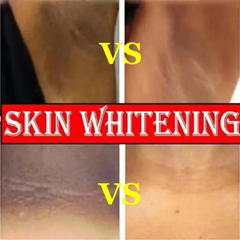 Retinol Brightening Cream – Underarm, Neck & Body Skin Tone Brightening Body Cream Qme