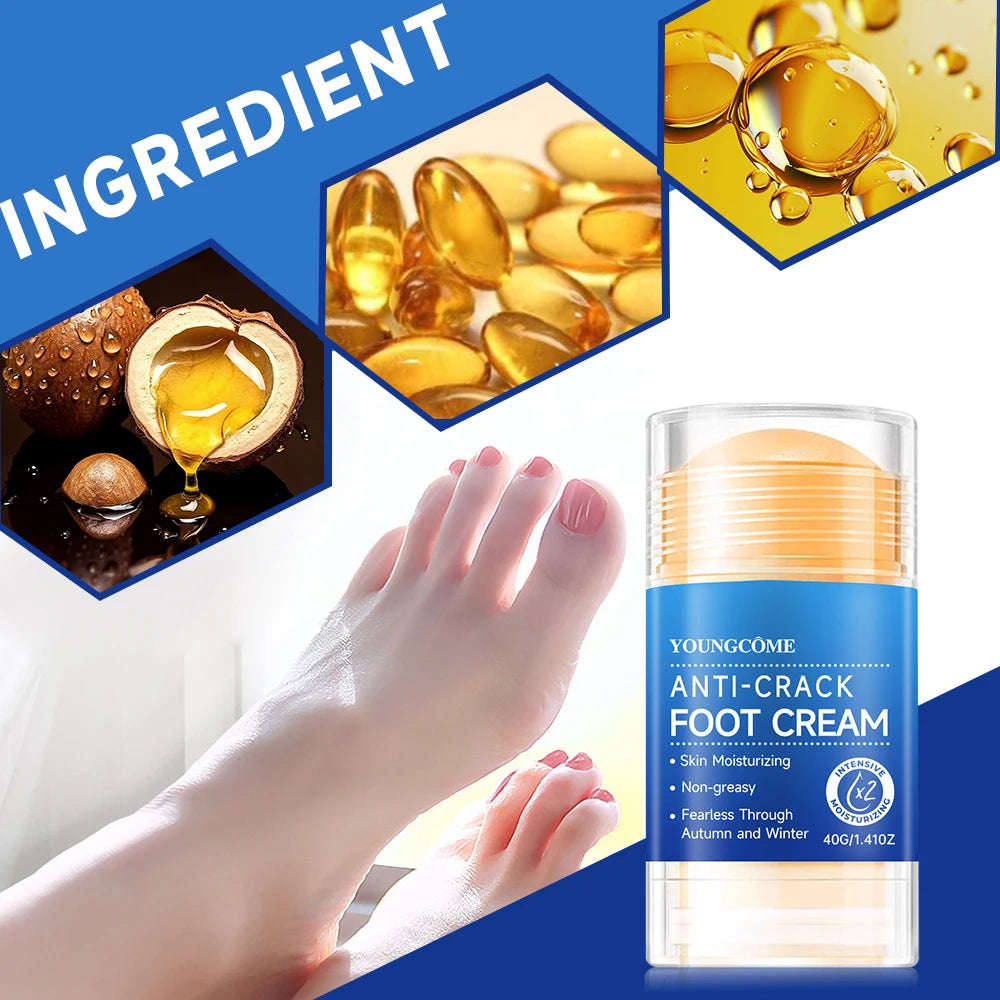 YOUNGCOME Cracked Heel Cream 2-Pack – Moisturizing Foot Ointment Foot Heel Cream Qst