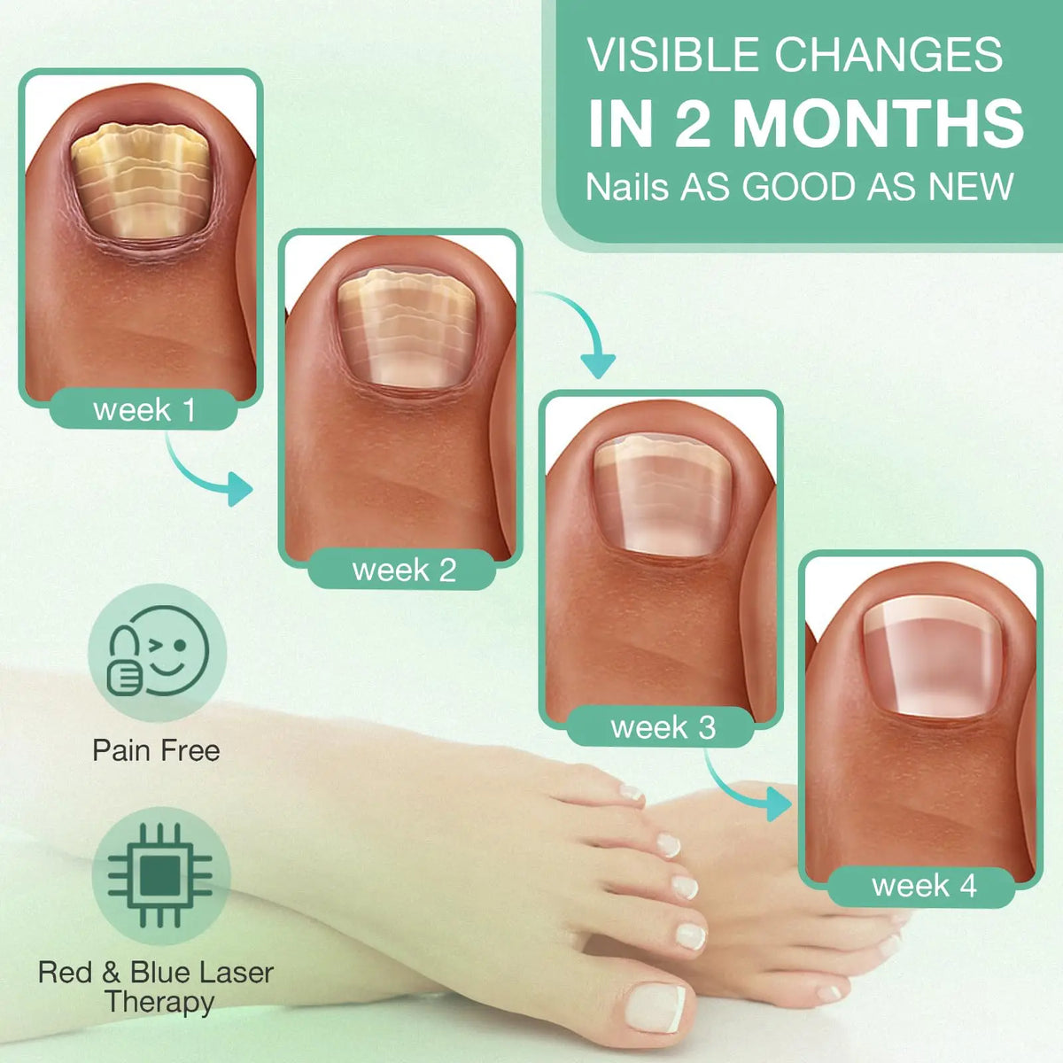 Wireless Blue & Red LED Nail Light Therapy Device | Jitesy S15 LED Nail Care Device Qst