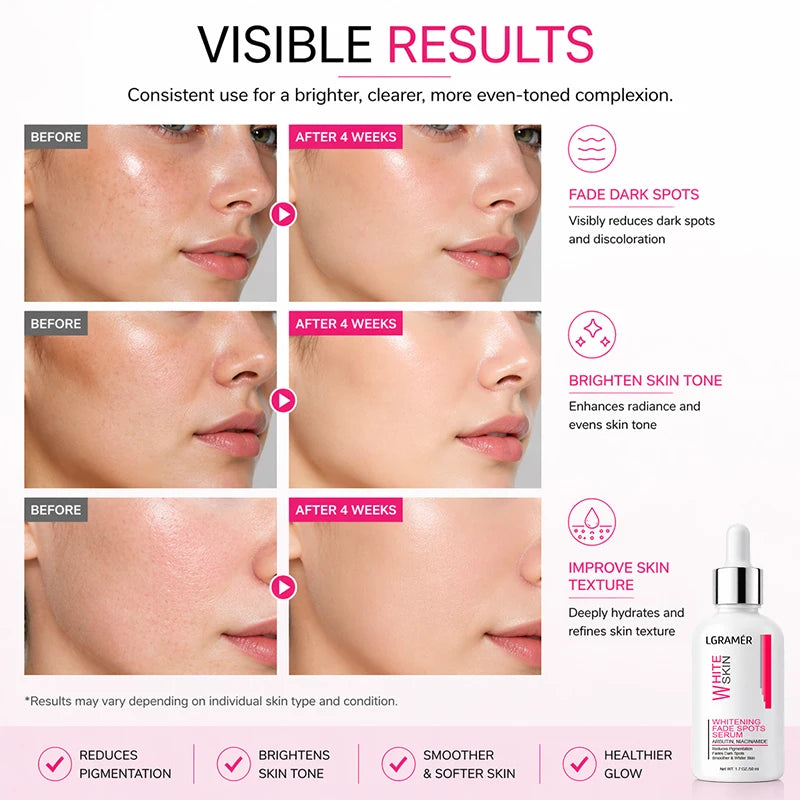 YOUNGCOME Niacinamide Brightening Face Serum | Moisturizing Face Serum Qst