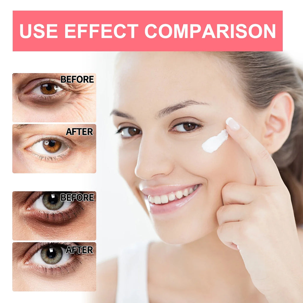 Retinol Eye Cream Stick – Brighten, Firm & Smooth Under Eyes Retinol Eye Cream Qme