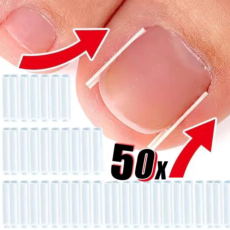 Invisible Toenail Shaping Support Stickers – 50pc Nail Care Nail Care Stickers Qme