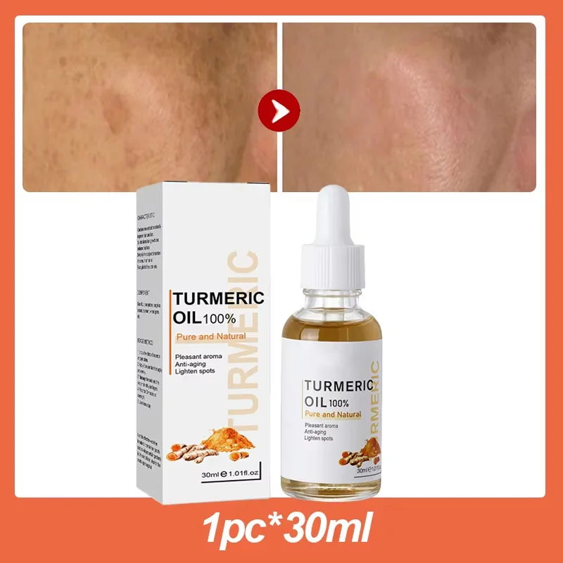 Turmeric Repair Essence – Brightens Dark Spots & Moisturizes Brightening Face Serum Qme 1pc