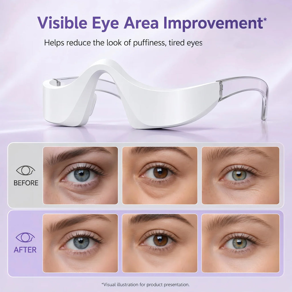 VIMYSHOW LED Eye Massager – 3-Color Light Beauty Device LED Eye Massager Qst