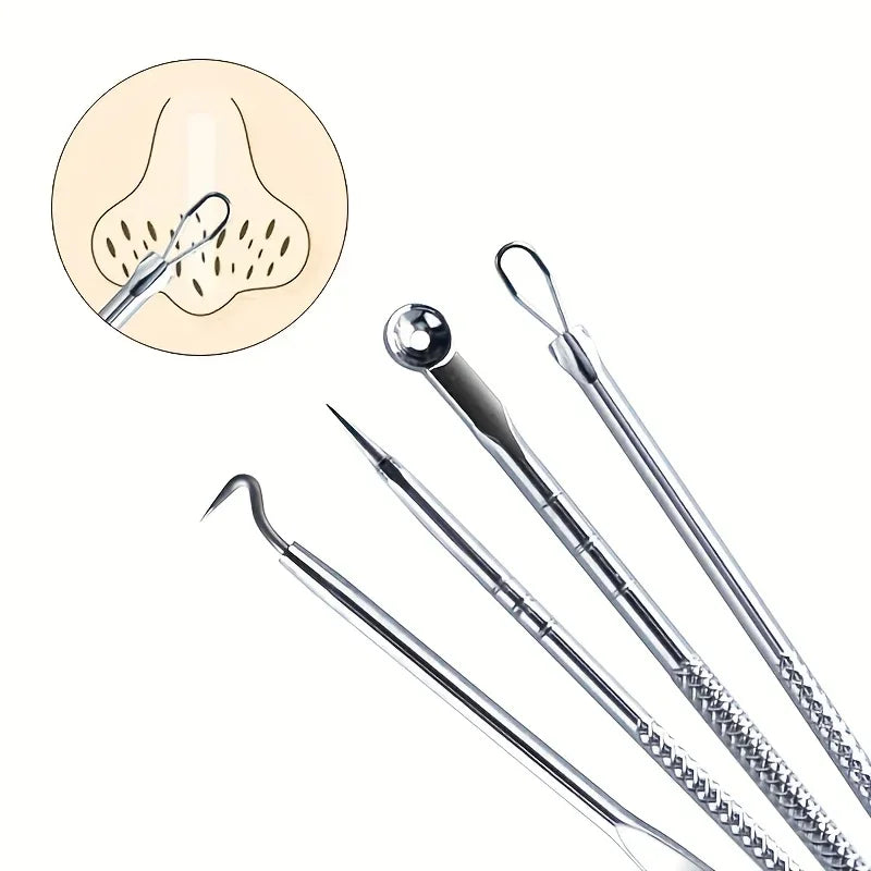4-Piece Blackhead Comedone Extractor Tool Set – Pore Cleanser Skin Care Tool Set Qme