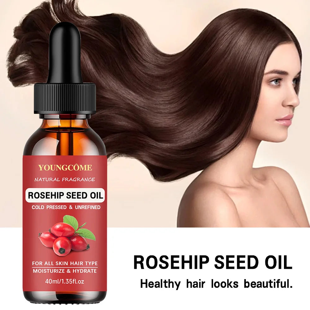 YOUNGCOME Rose Essential Oil – Aromatherapy & Skin Care 40/60ml Essential Oil Qst
