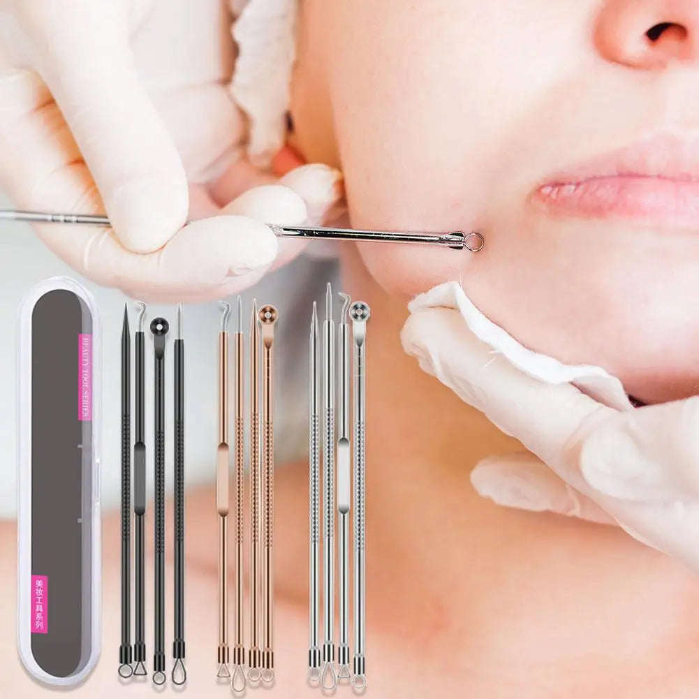 4-Piece Blackhead Remover Tool Set – Curved Tweezers & Needle Blackhead Remover Set Qme