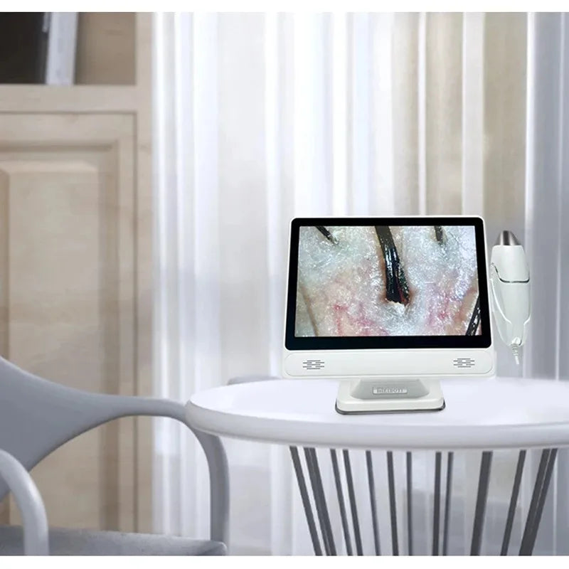 HD Hair Scalp Camera & Digital Skin Analyzer – 10" Screen Scalp Skin Analyzer Qst