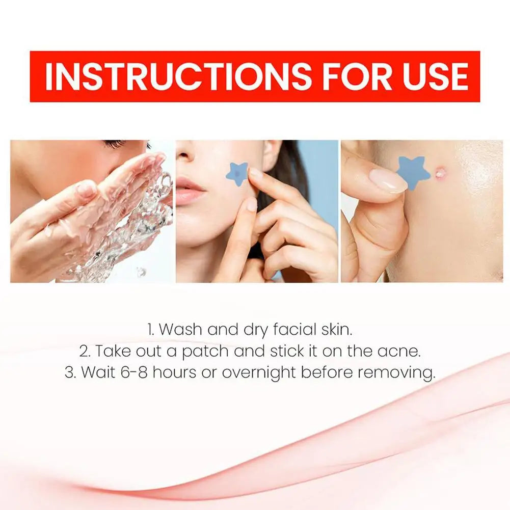 Colorful Invisible Pimple Patches – 216pc Spot Stickers Pimple Patch Qme