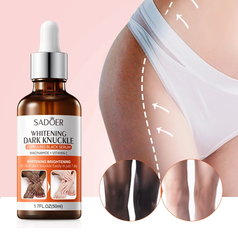 Knuckle & Joint Brightening Serum – Elbows, Knees, Hands 50ml Body Brightening Serum Qst