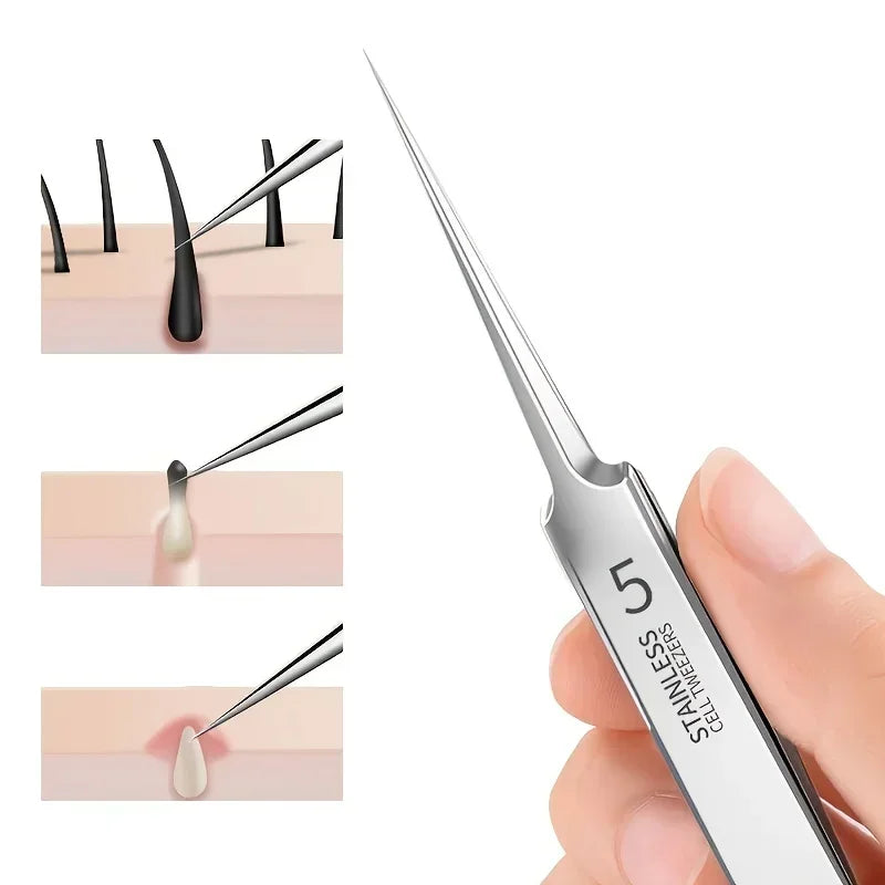 Extra Fine Blackhead Tweezers – Stainless Steel Facial Tool | Qme Facial Tweezers Qme