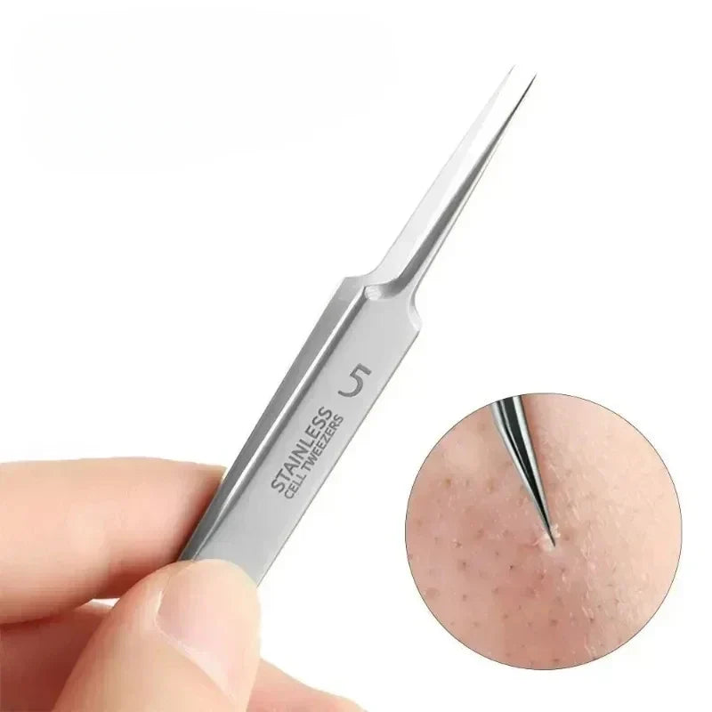 Precision Blackhead & Whitehead Removal Tweezers | Qme Facial Removal Tool Qme
