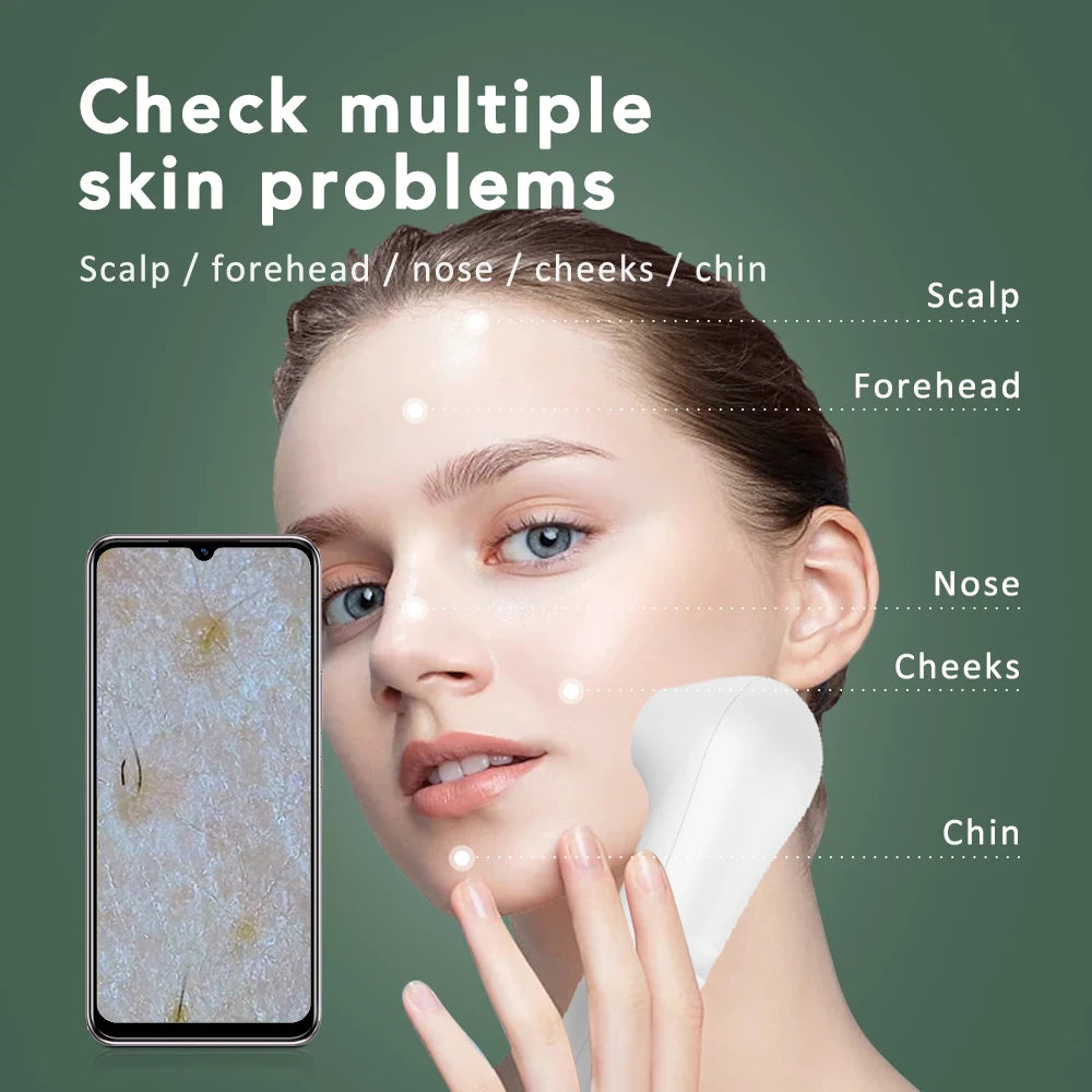 Maelsrom Wireless Scalp & Skin Analyzer – 4x HD Camera Skin Scalp Analyzer Qst