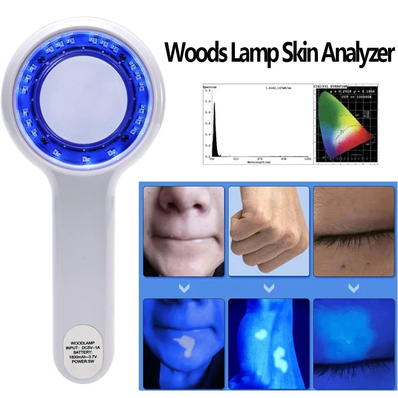 Wood's Lamp Portable UV Skin Analyzer – 365nm Facial Tool UV Skin Analyzer Qst