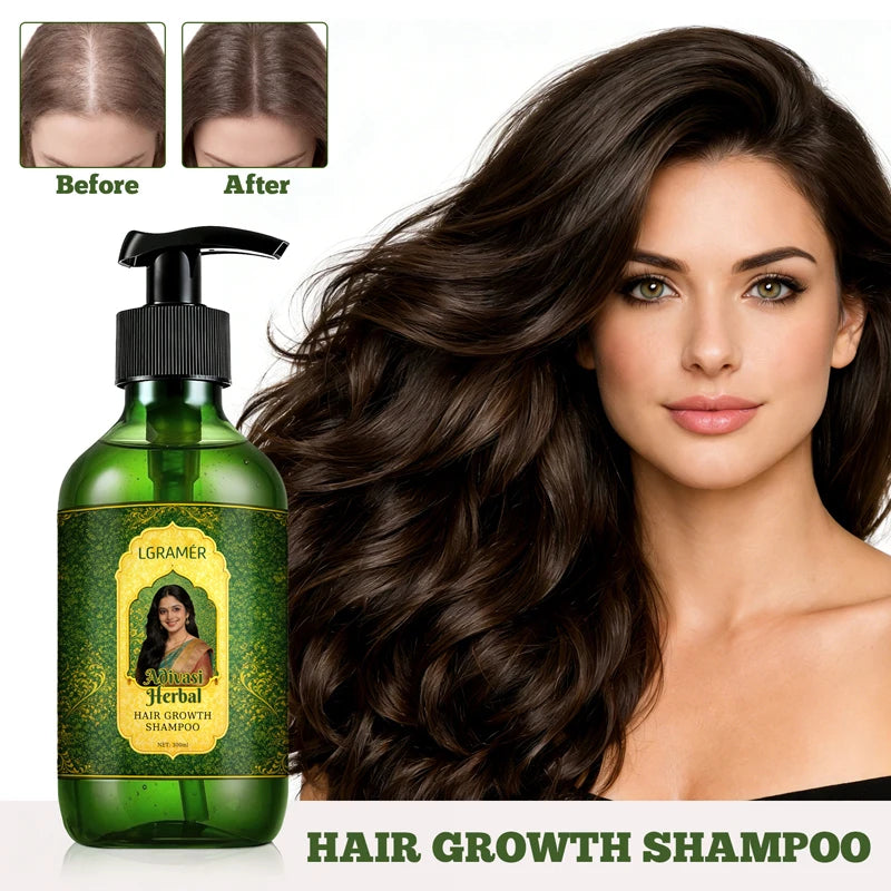 LGRAMER Hair Growth Shampoo 300ml – Volume & Scalp Care Hair Growth Shampoo Qst