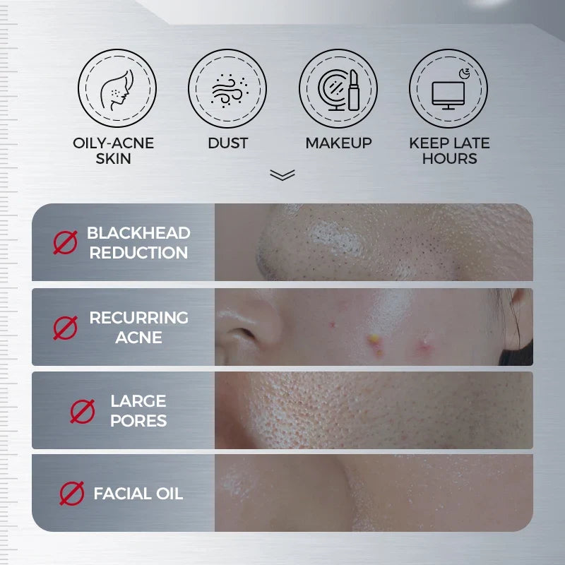 NING DERMOLOGIE Amino Acid Korean Facial Cleanser Facial Cleanser Qme