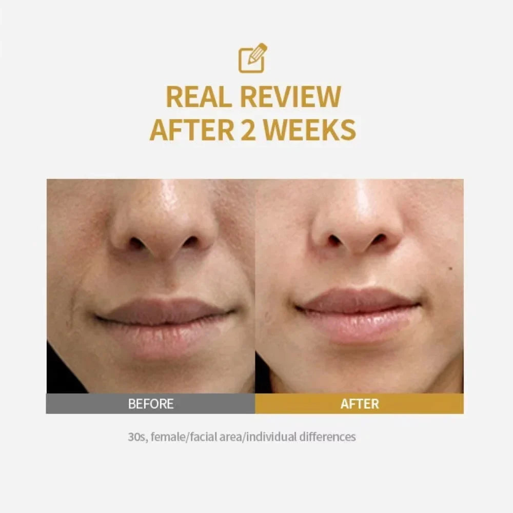 Peptide Lifting Ampoule – Deep Collagen Face Firming Serum Collagen Lifting Serum Qme
