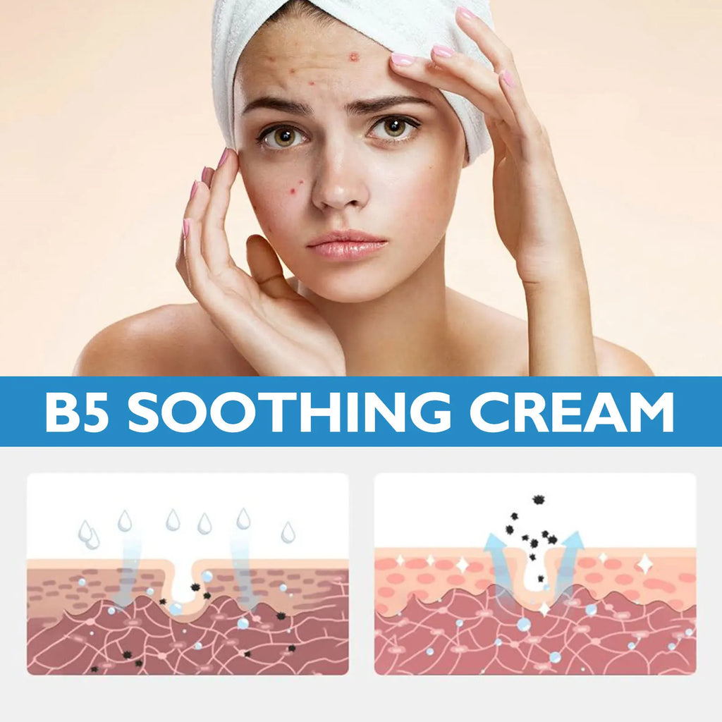 B5 Repair Cream – Hydrating Moisturizer for Dry Skin Face Moisturizer Cream Qme