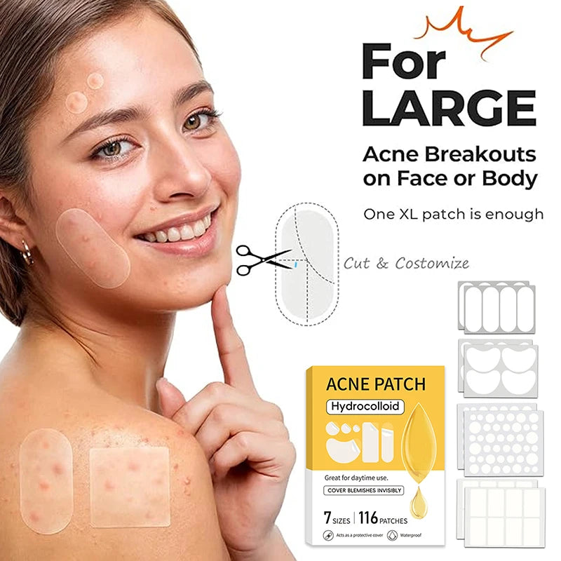 116Pcs Invisible Blemish Patches – Spot Concealer Stickers Blemish Patch Set Qst
