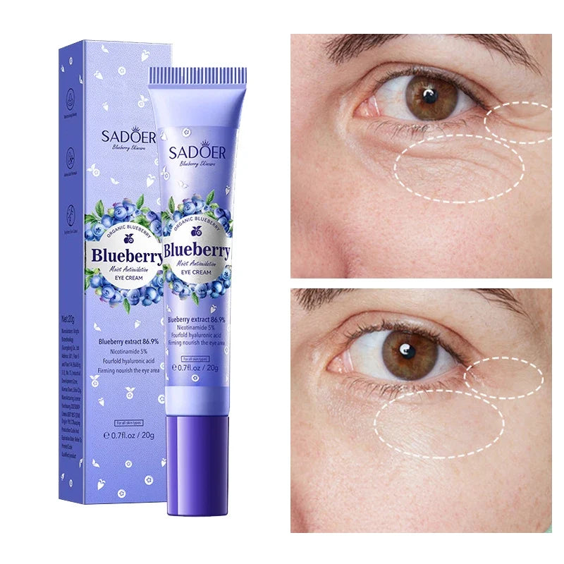 Blueberry Eye Cream – Moisturizing, Firming & Hydrating Eye Cream Qme