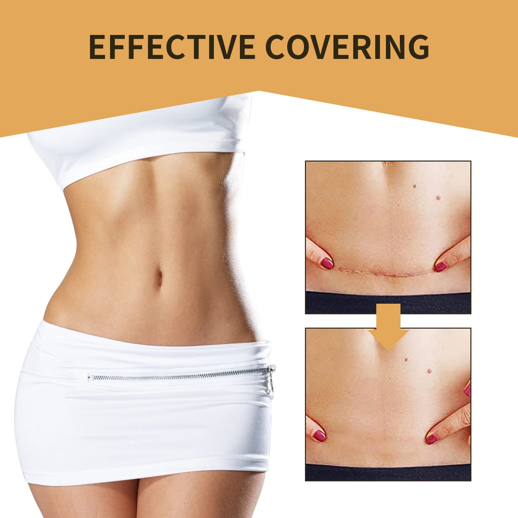 5-Pack Invisible Concealer Stickers – Waterproof & Breathable Skin Concealer Stickers Qst