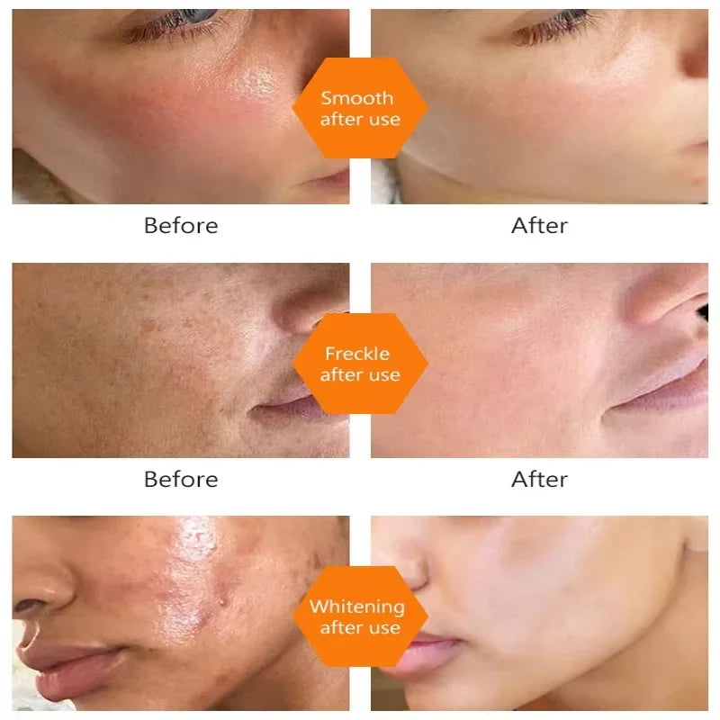 Turmeric Repair Essence – Brightens Dark Spots & Moisturizes Brightening Face Serum Qme