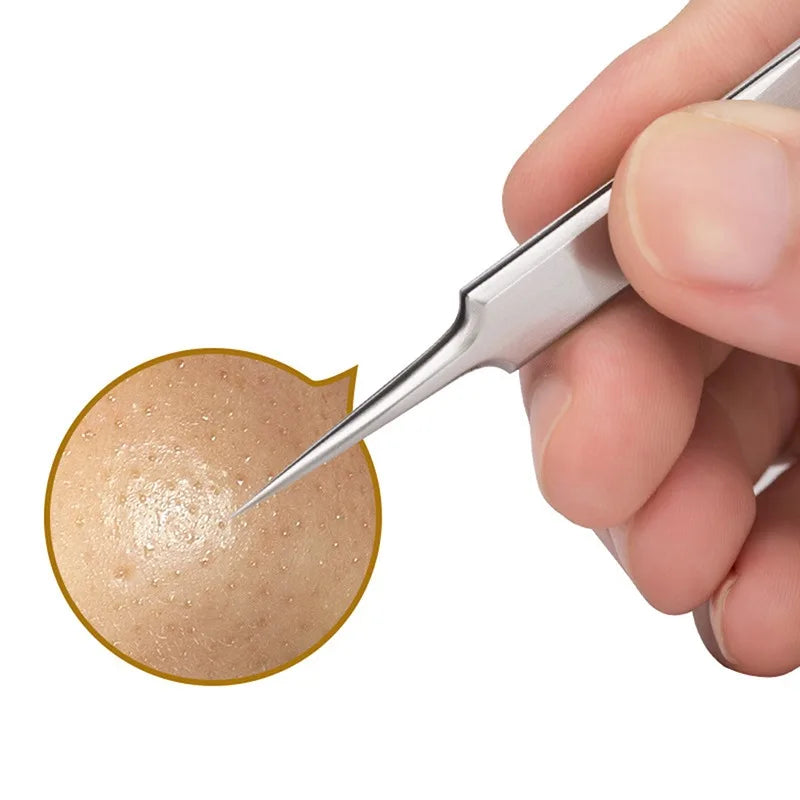 Precision Stainless Steel Blackhead & Pore Cleansing Tweezers Facial Skincare Tool Qme