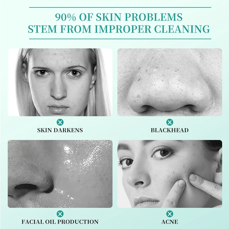 Salicylic Acid Face Cream – Pore Minimizing & Oil Control 30g Salicylic Acid Cream Qst