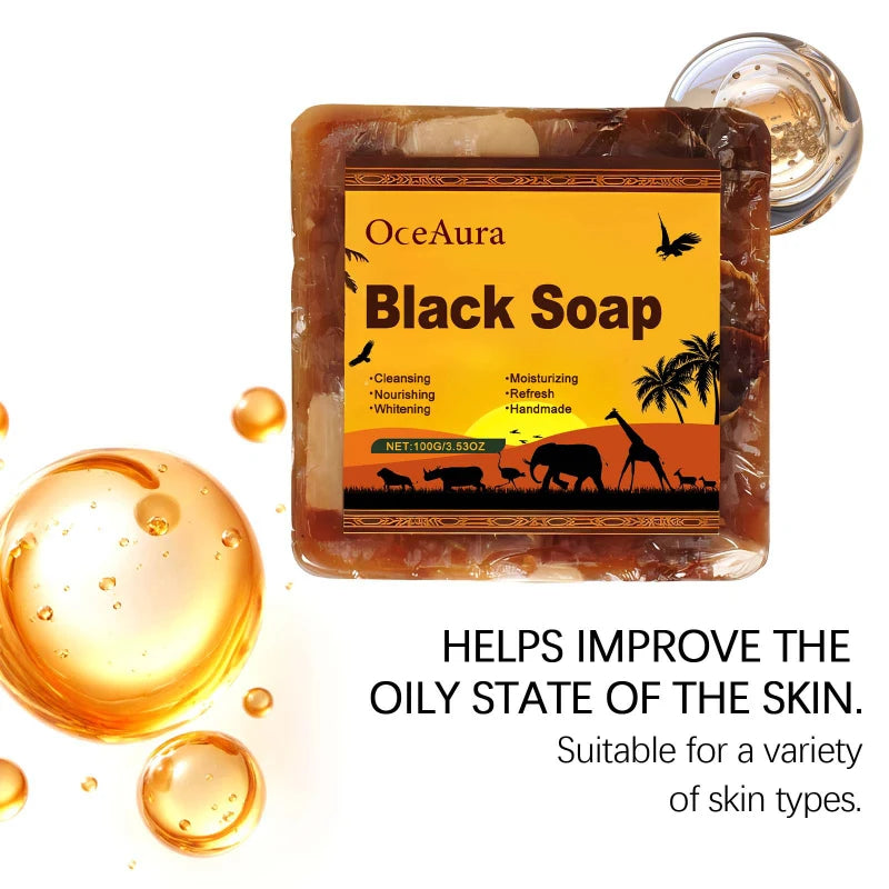 African Black Soap 100g – Coconut Oil Moisturizing Body Bar Cleansing Bar Soap Qst